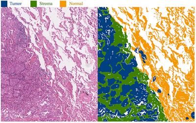 WSSS-CRAM: precise segmentation of histopathological images via class region activation mapping